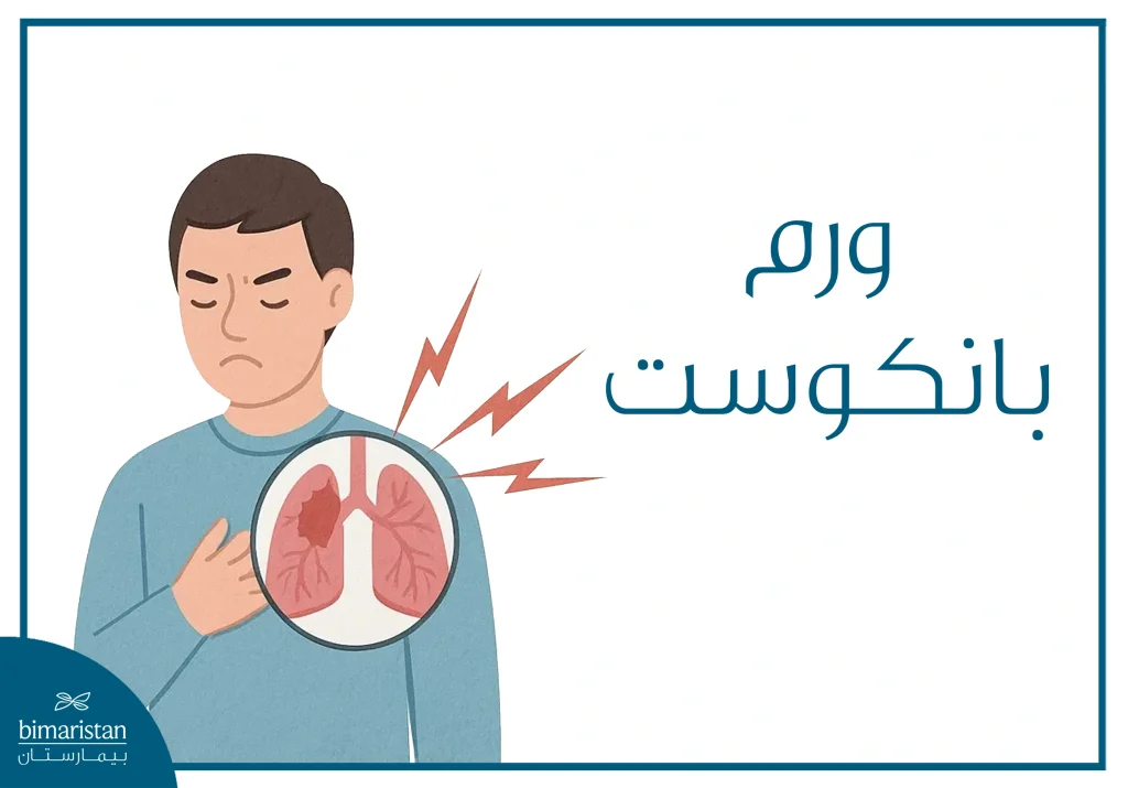 ورم بانكوست