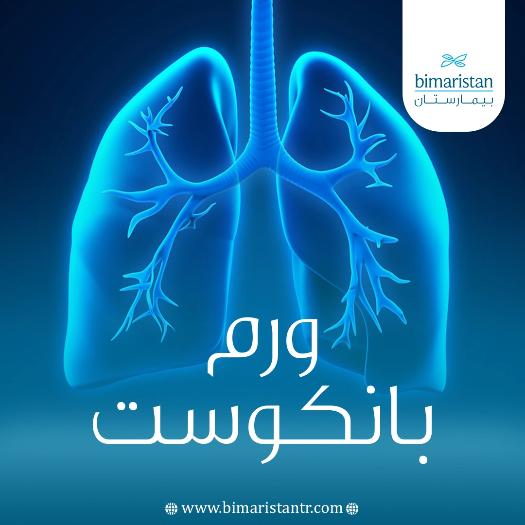 ورم بانكوست