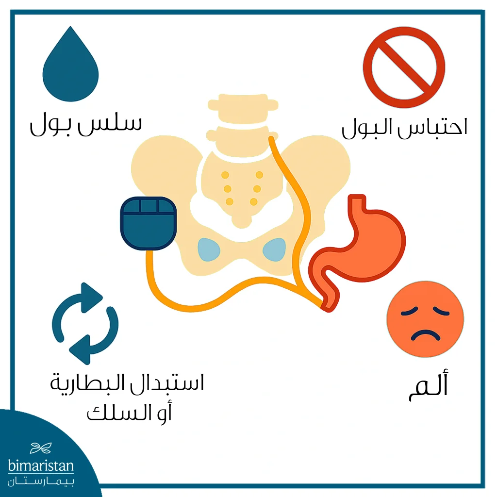 بطارية المثانة العصبية: تقنية للتحكم بالمثانة 3 مخاطر بطارية المثانة العصبية