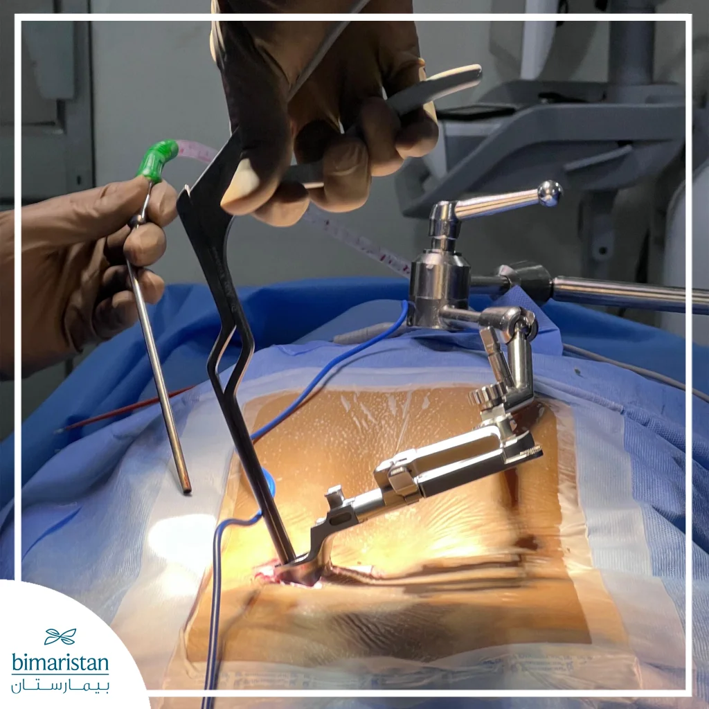 Minimally Invasive Spine Surgery: What Does It Offer Us?