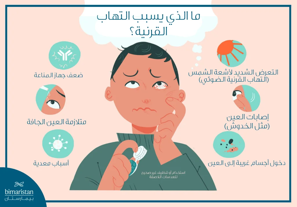 الصورة توضّح الأسباب المحتملة لالتهاب القرنية، مثل العدوى وضعف المناعة،وجفاف العين وسوء استخدام العدسات اللاصقة،والإصابات،ودخول أجسام غريبة والتعرض الزائد لأشعة الشمس.