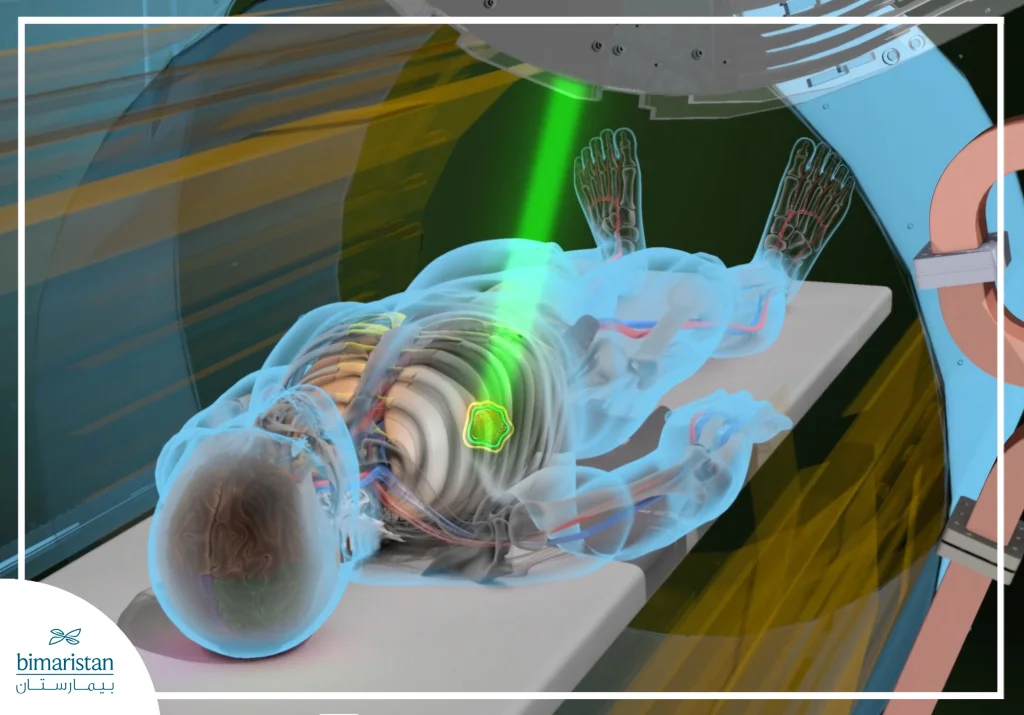 An Illustrative Image Of A Radiation Therapy Session, Where A Precise Beam Of Radiation Is Directed At The Tumor Inside The Body While Preserving The Surrounding Healthy Tissues
