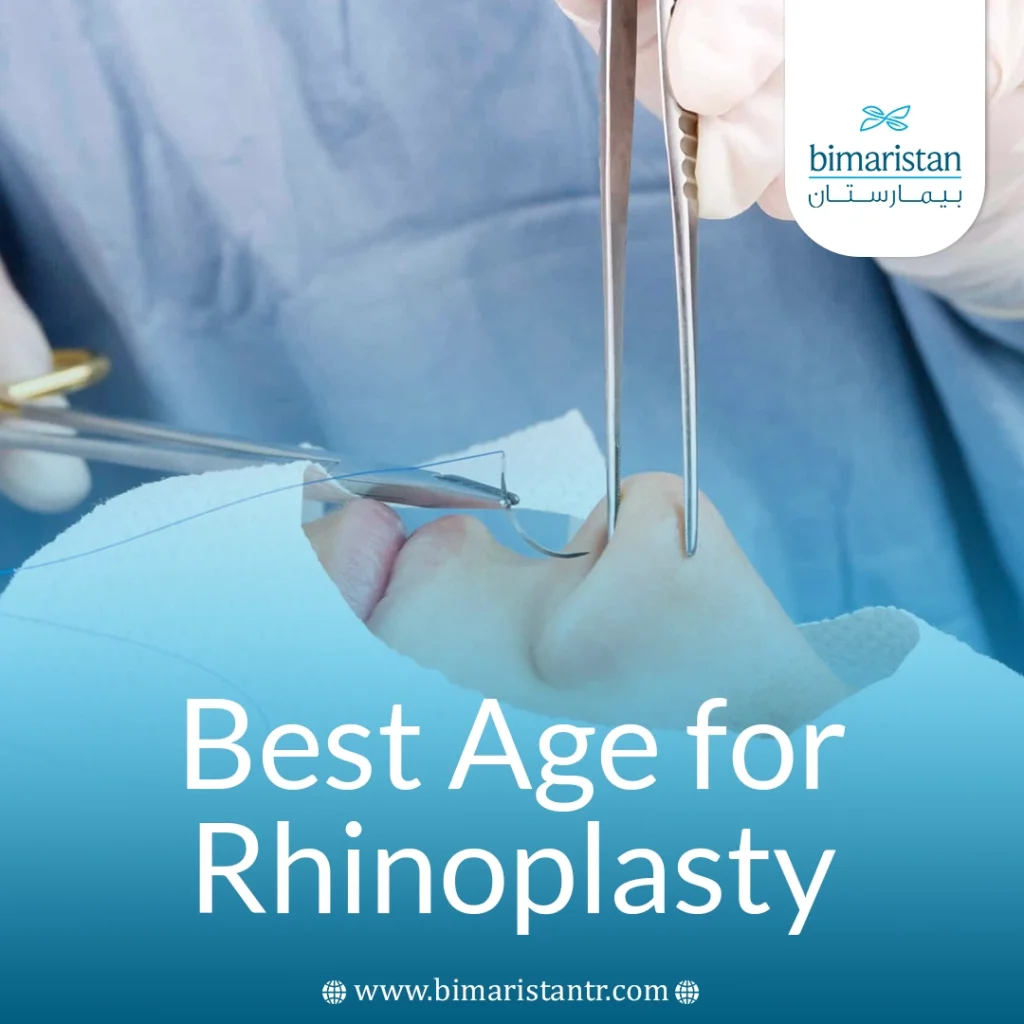 The Best Age For Rhinoplasty: When Is The Ideal Time To Have The Procedure? 4 Best Age For Rhinoplasty