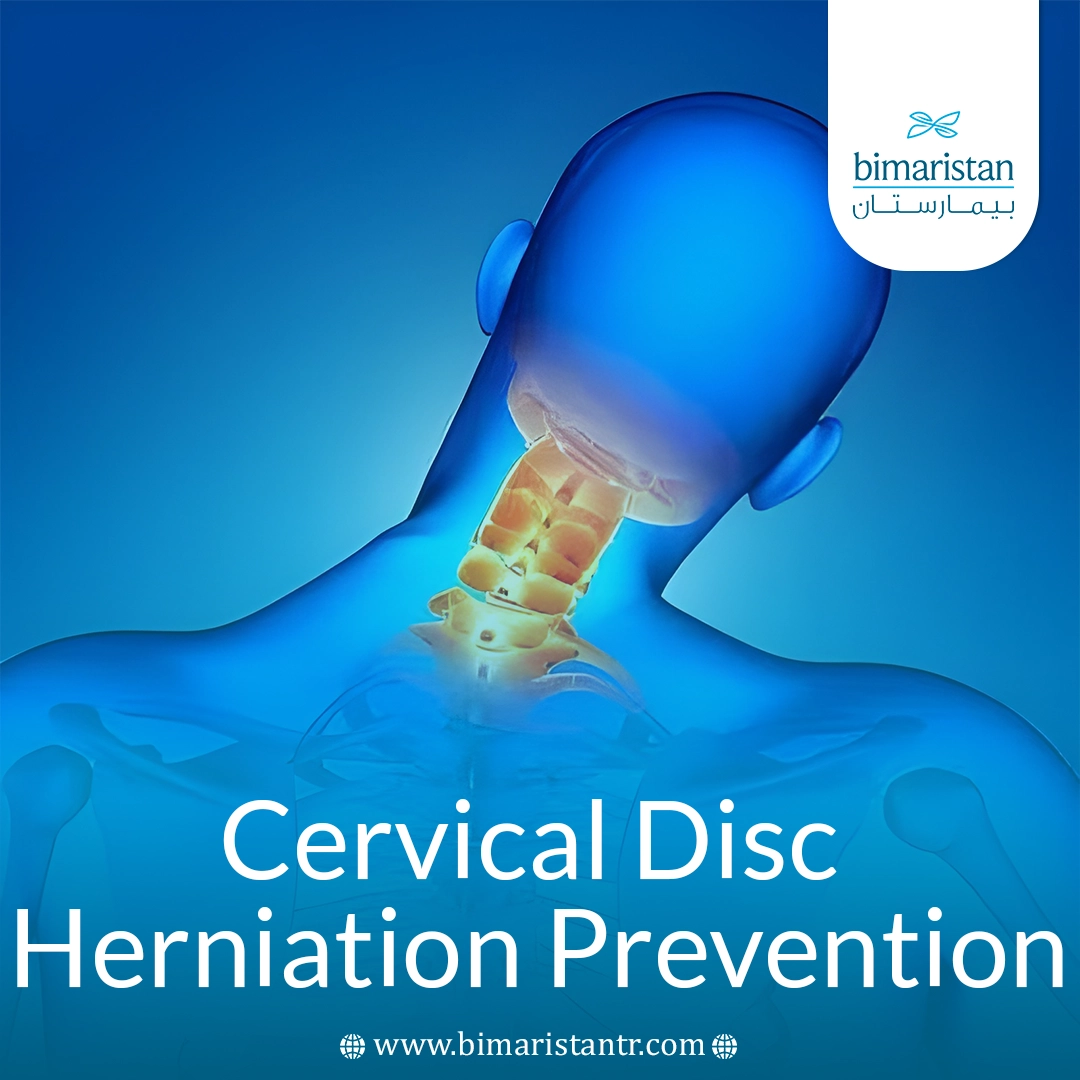 Cervical Disc Herniation Prevention