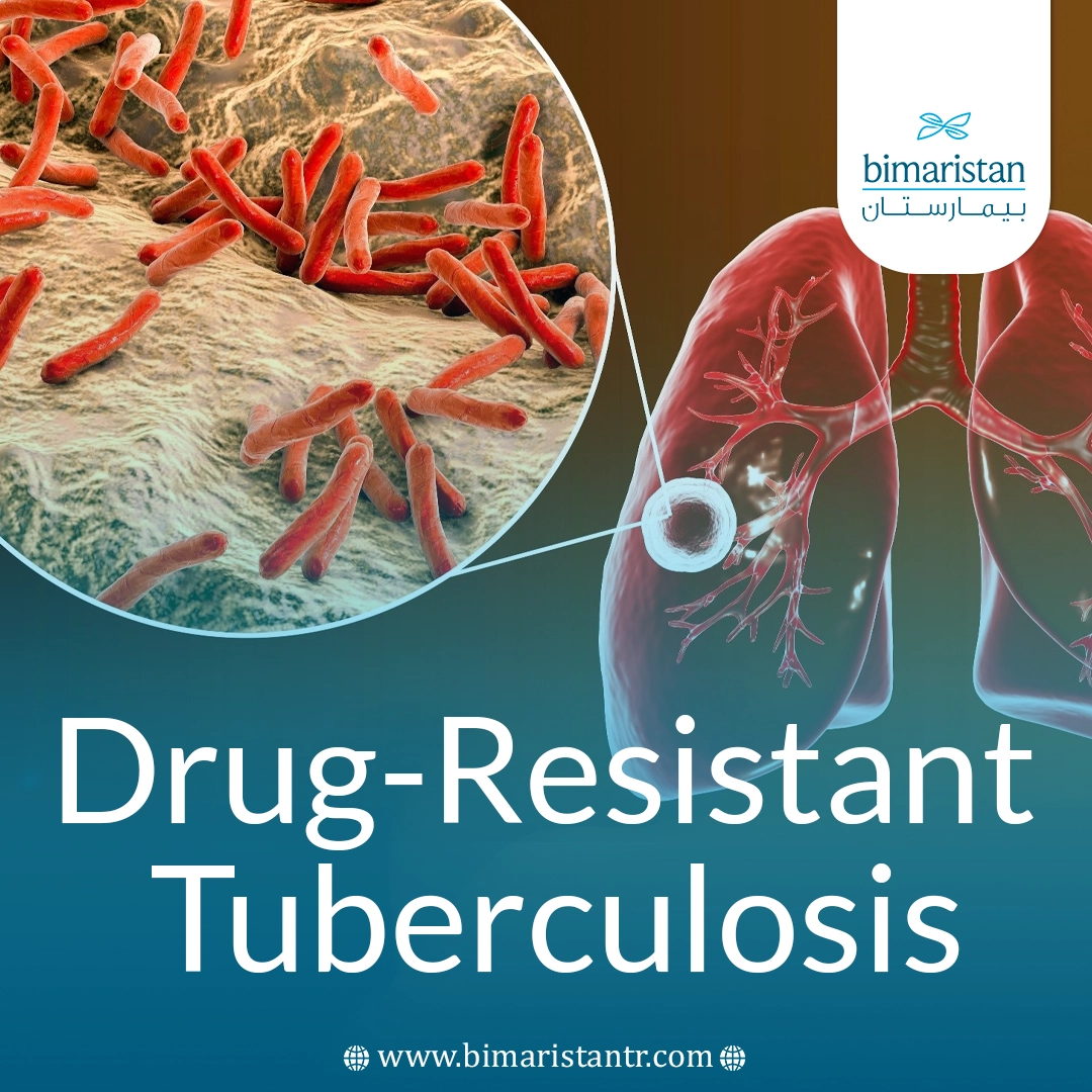 Drug-Resistant Tuberculosis