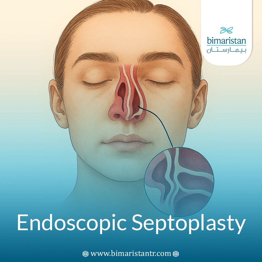 Endoscopic Septoplasty