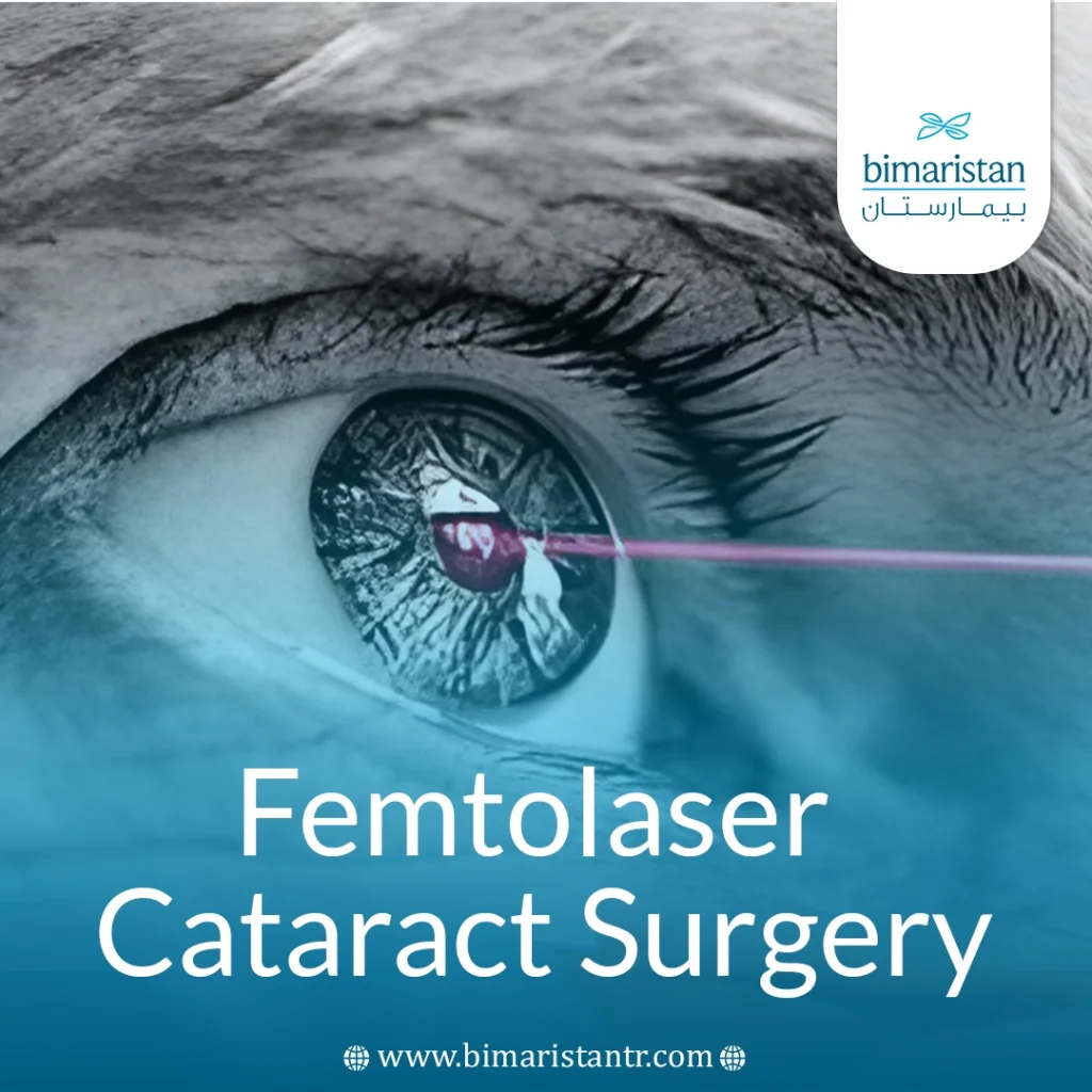 Femtolaser Cataract Surgery