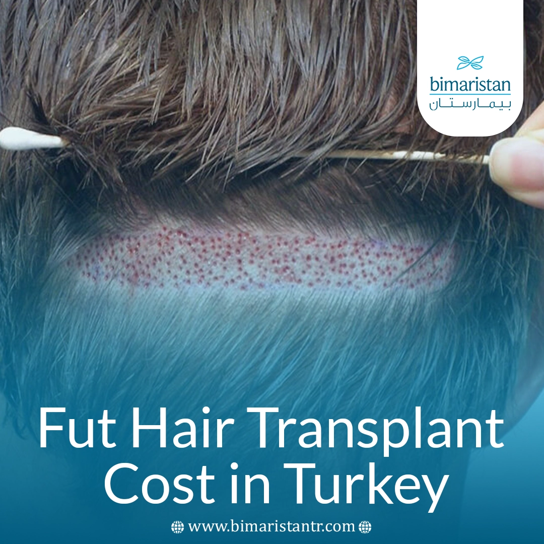 Fut Hair Transplant Cost In Turkey 2026: Prices, Procedure Steps &Amp;Amp; Expected Results 1 Fut Hair Transplant Cost In Turkey 2026: Prices, Procedure Steps &Amp;Amp; Expected Results