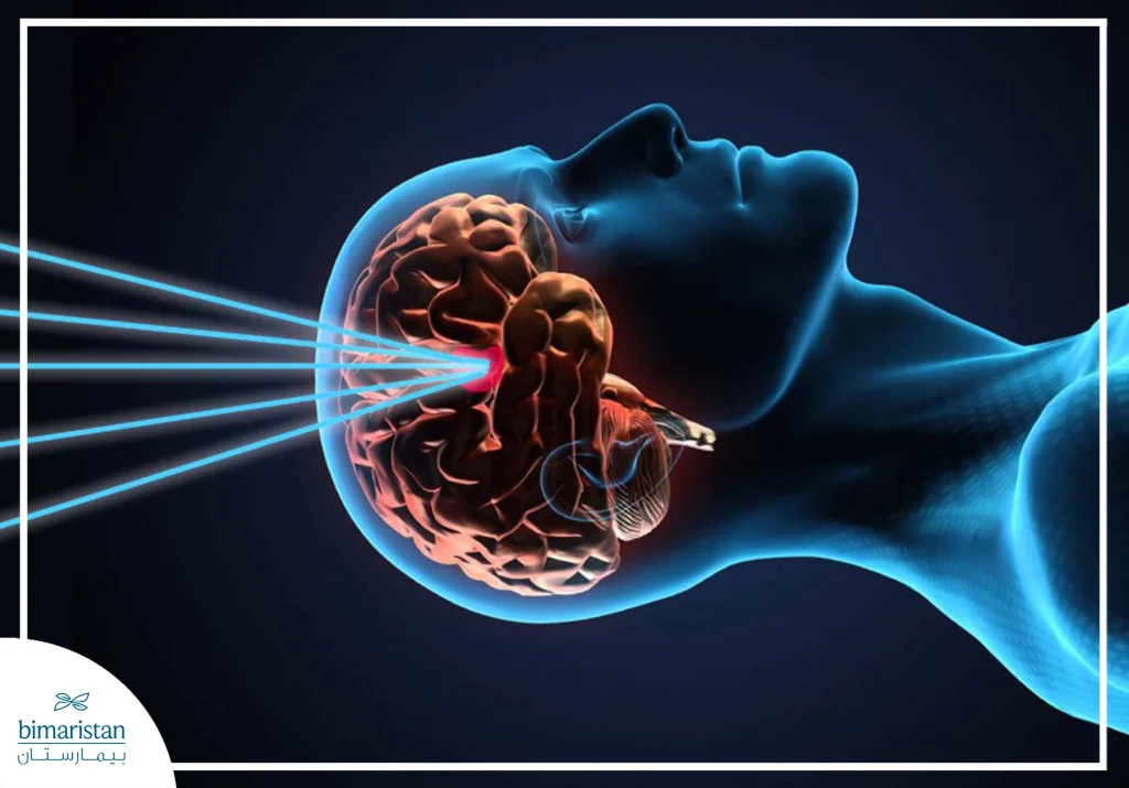 Gamma-Knife Treatment
