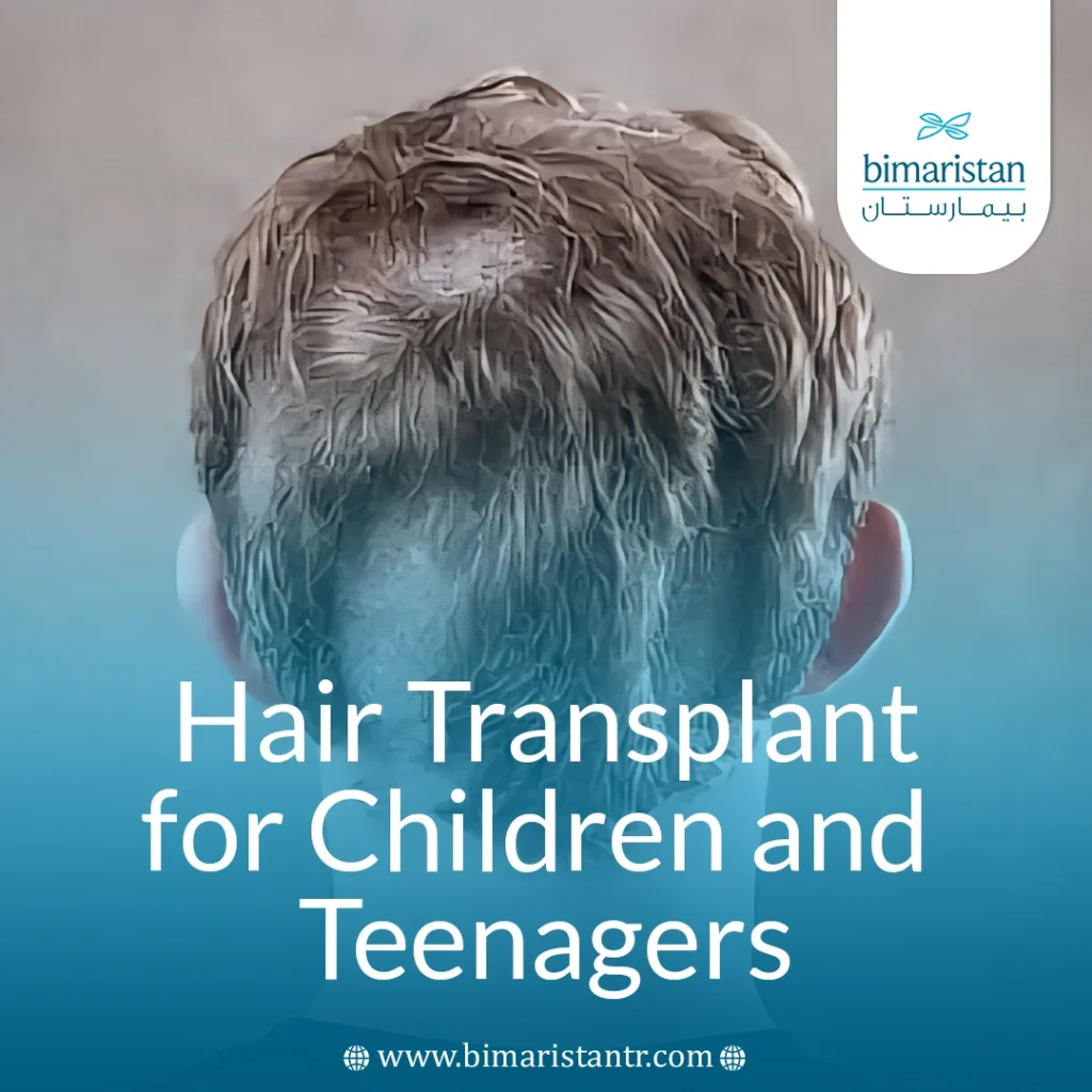 Hair Transplants For Children And Teens: A Comprehensive Guide To Causes And Treatment 4 Hai̇r Transplant For Chi̇ldren And Teenagers