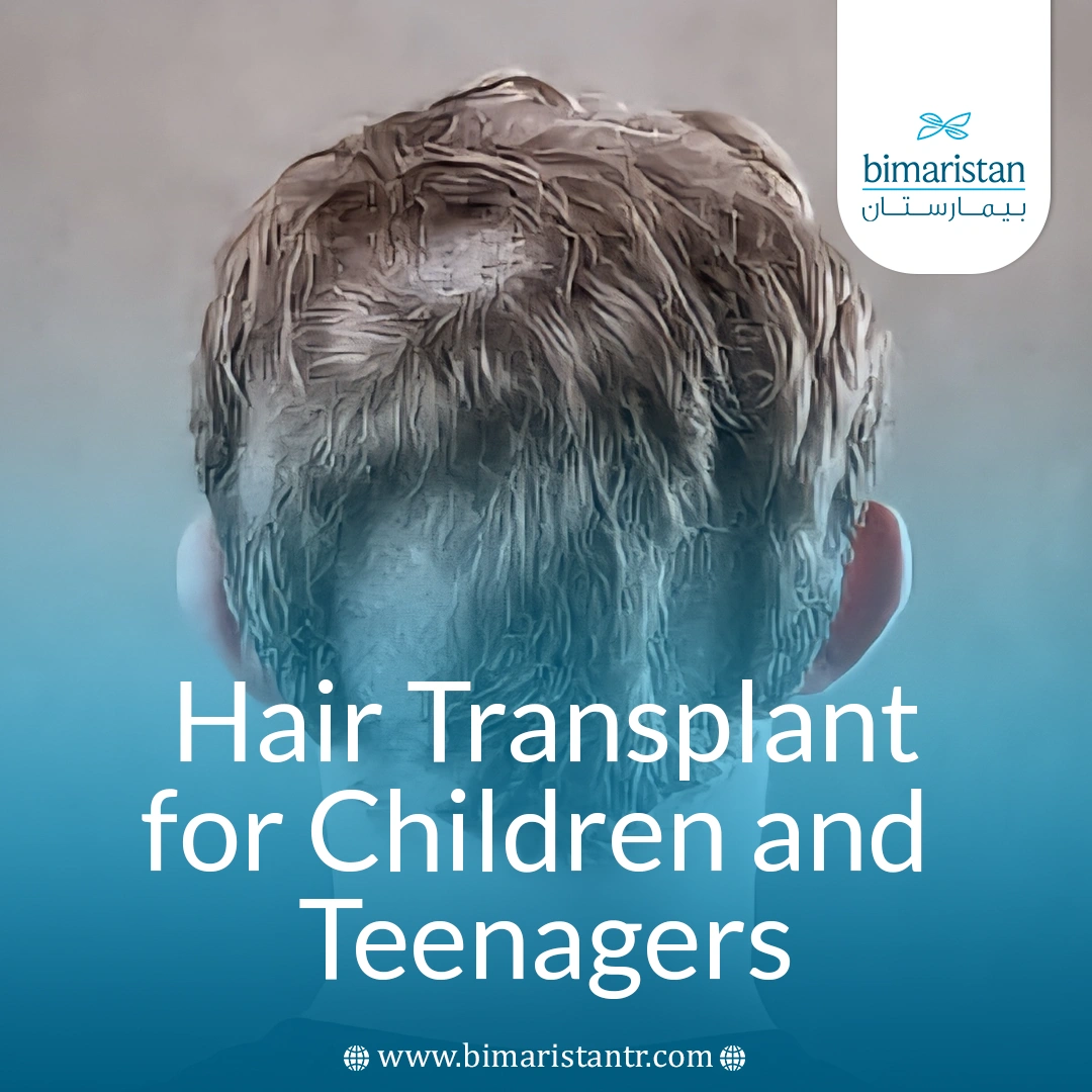 Hair Transplants For Children And Teens: A Comprehensive Guide To Causes And Treatment 533 Hai̇r Transplant For Chi̇ldren And Teenagers