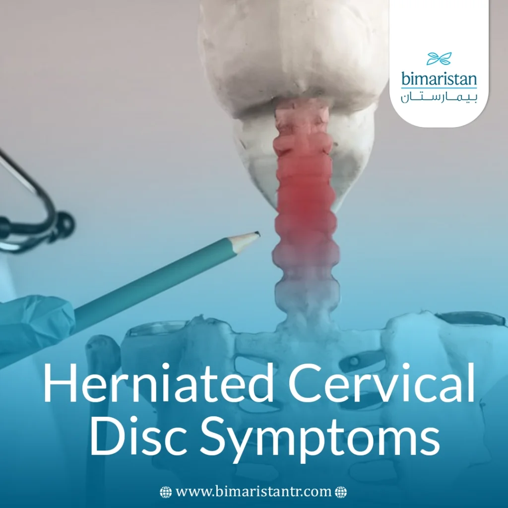 Herniated Cervical Disc Symptoms