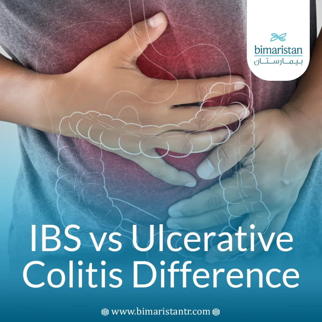Ibs Vs Ulcerative Colitis Difference