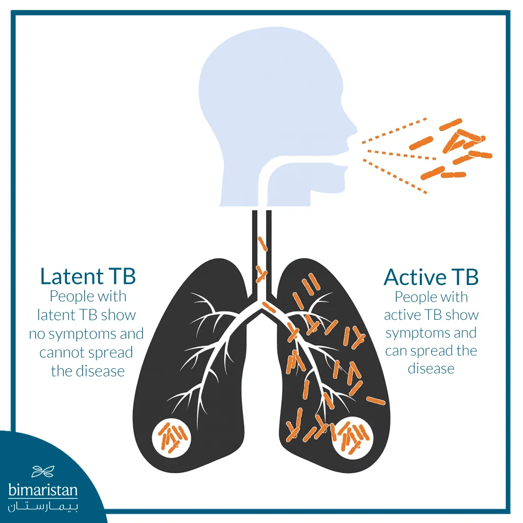 What Is Tuberculosis? Causes, Types, And Mechanism Of Infection 3 Illustration Showing The Difference Between Latent And Active Tb