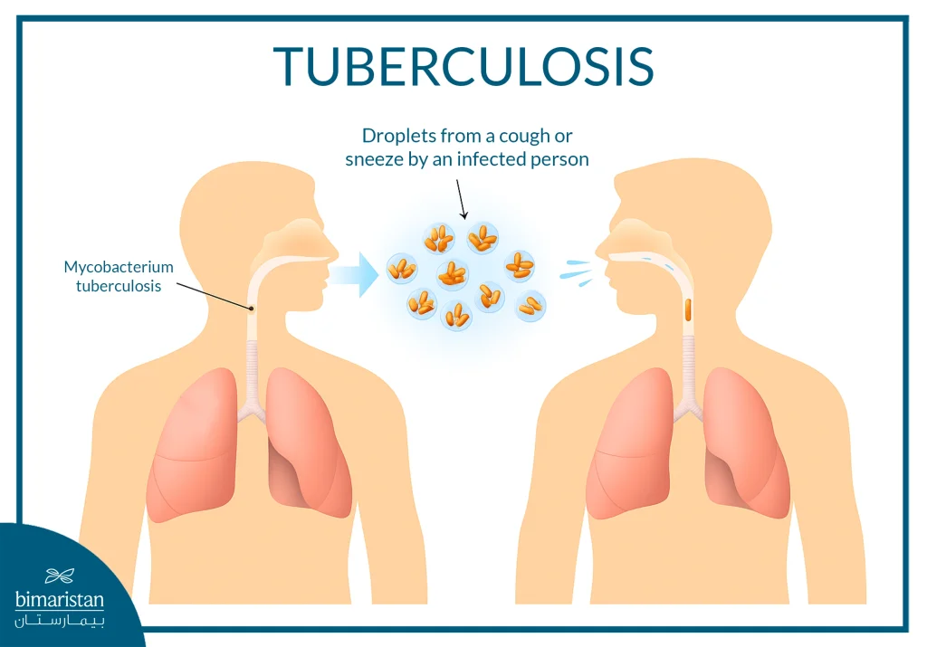 What Is Tuberculosis? Causes, Types, And Mechanism Of Infection 4 Illustration Showing Tuberculosis Transmission Through Respiratory Droplets