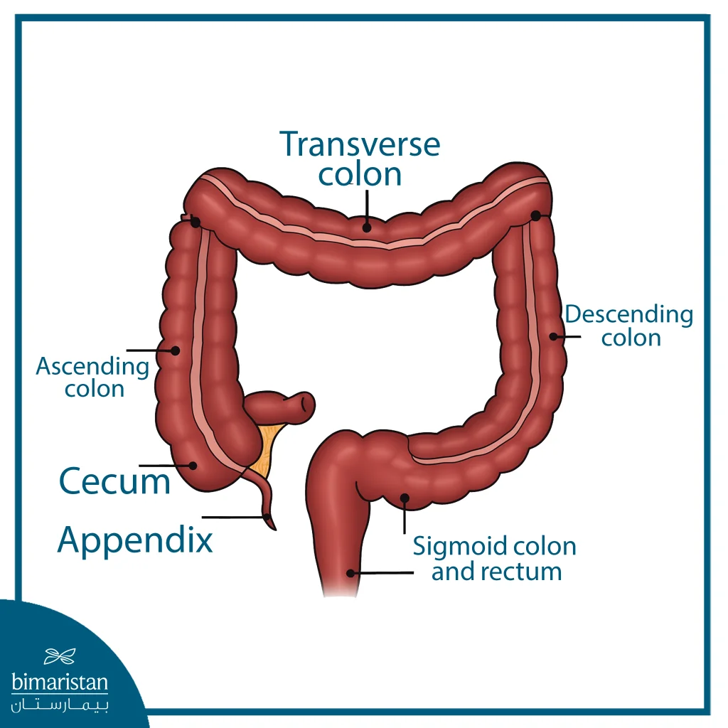 Image Showing The Anatomy Of The Colon (Large Intestine)