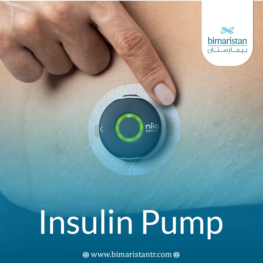 Insulin Pump