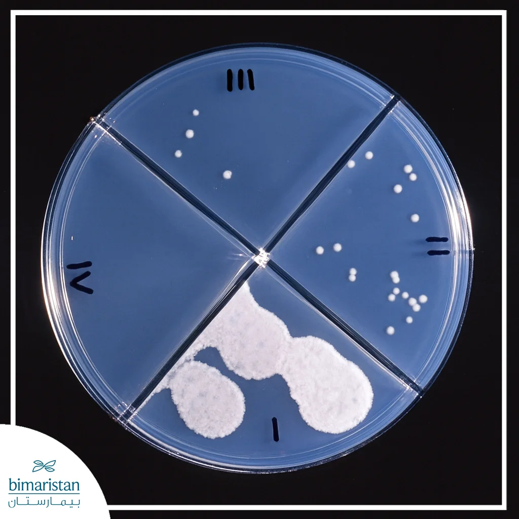 Drug-Resistant Tuberculosis: Causes, Symptoms, And Modern Treatment 3 Laboratory Petri Dish Showing Drug-Resistant Tuberculosis Bacteria Growth In Drug Susceptibility Test