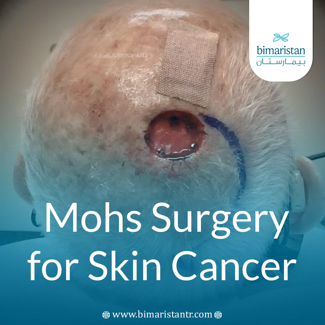 Mohs Surgery For Ski̇n Cancer