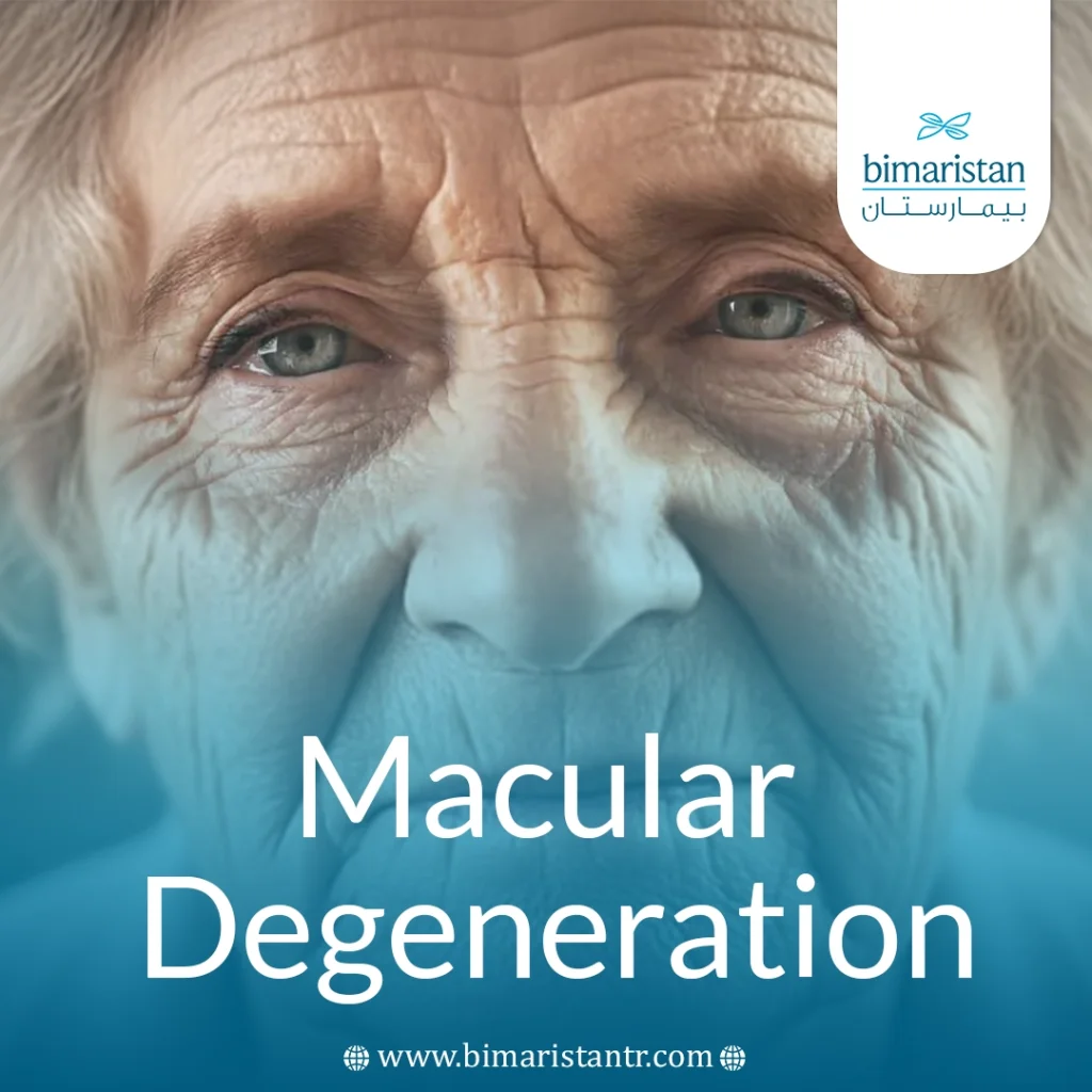 Macular Degeneration