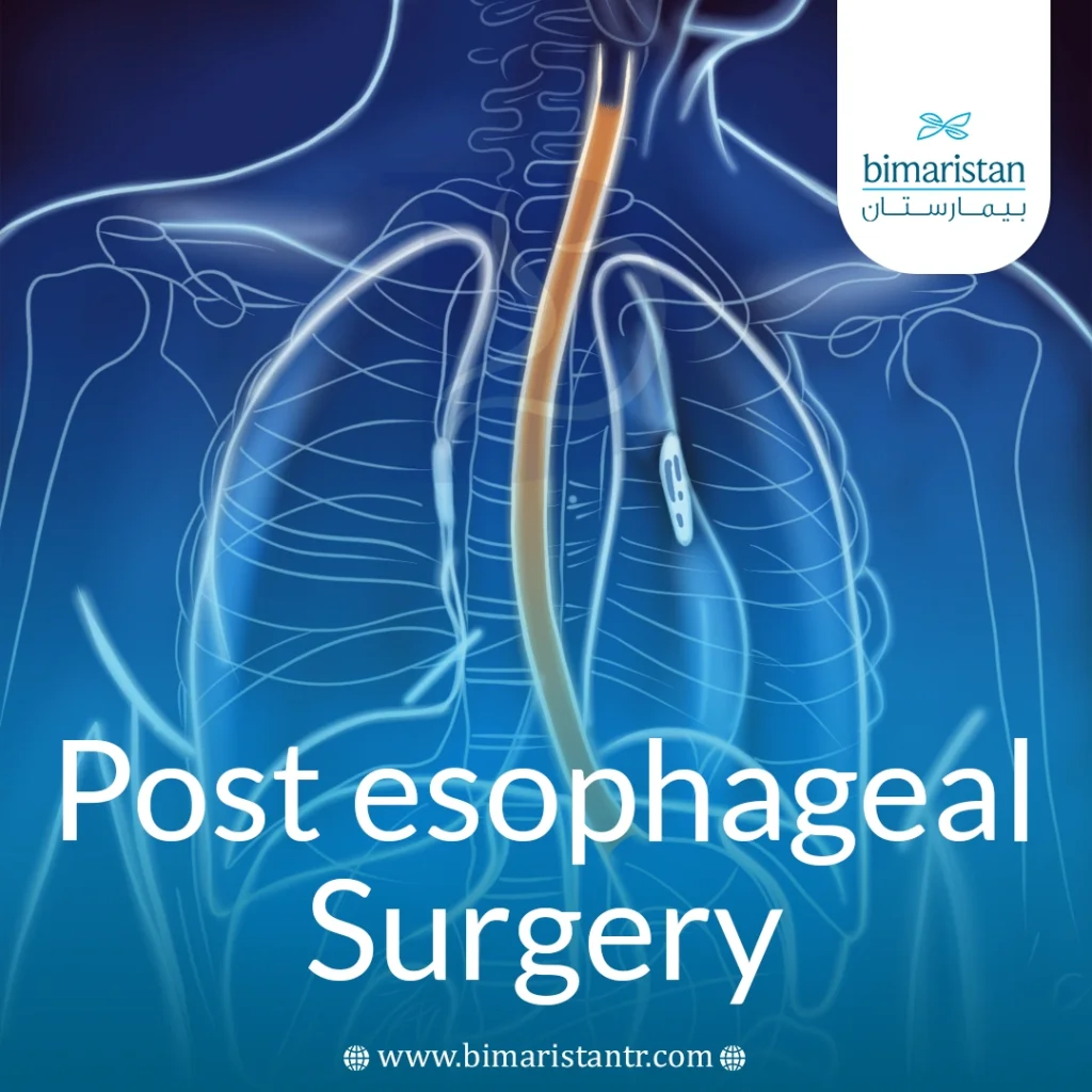 Post Esophageal Surgery