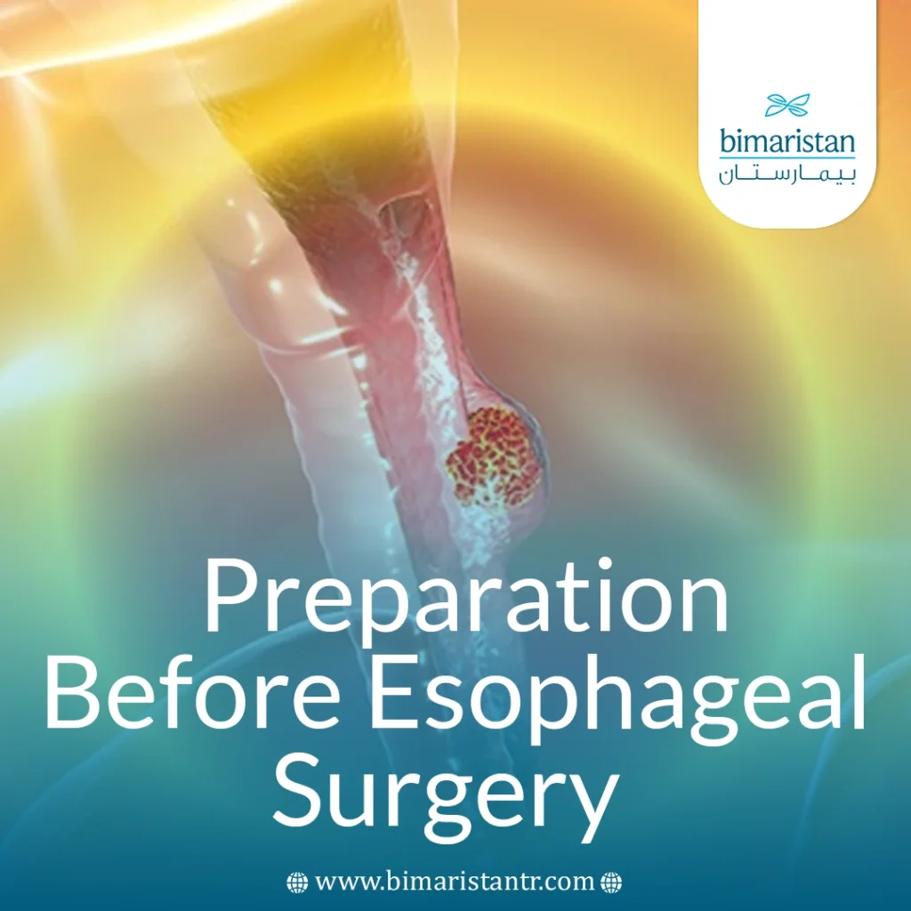 Preparation Before Esophageal Surgery