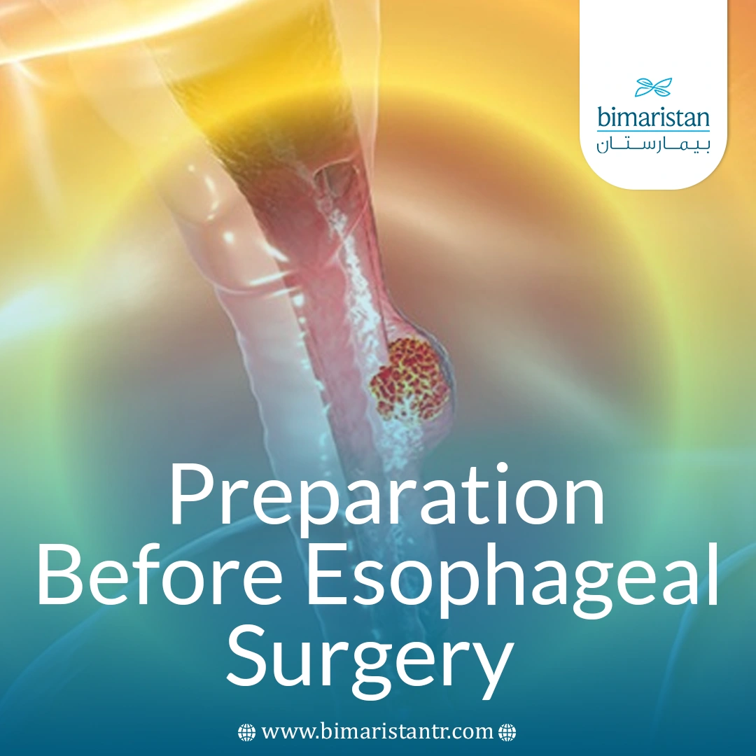 Preparation Before Esophageal Surgery