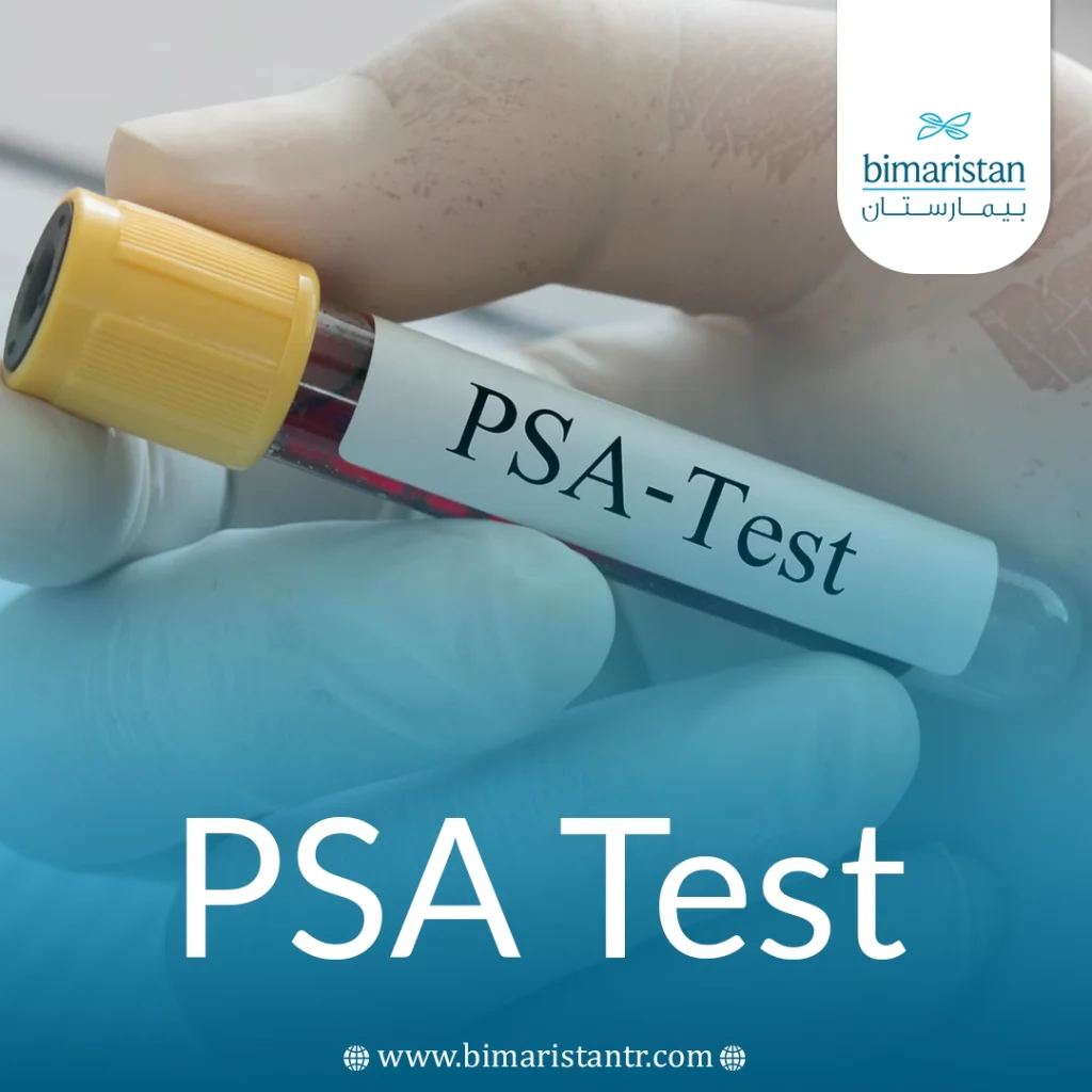 Prostate Specific Antigen (Psa Test) 4 Psa Test