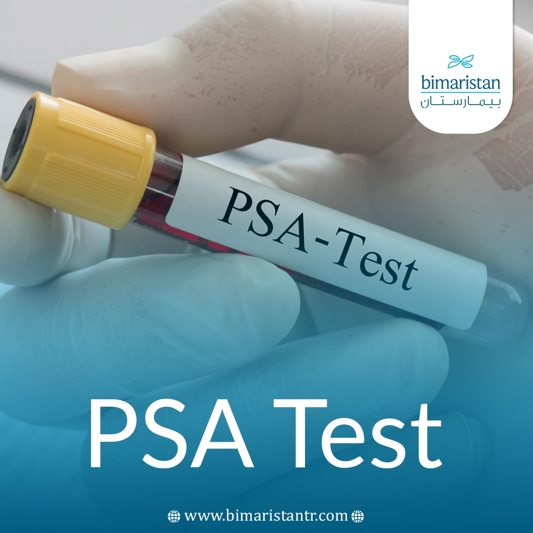 Psa Test