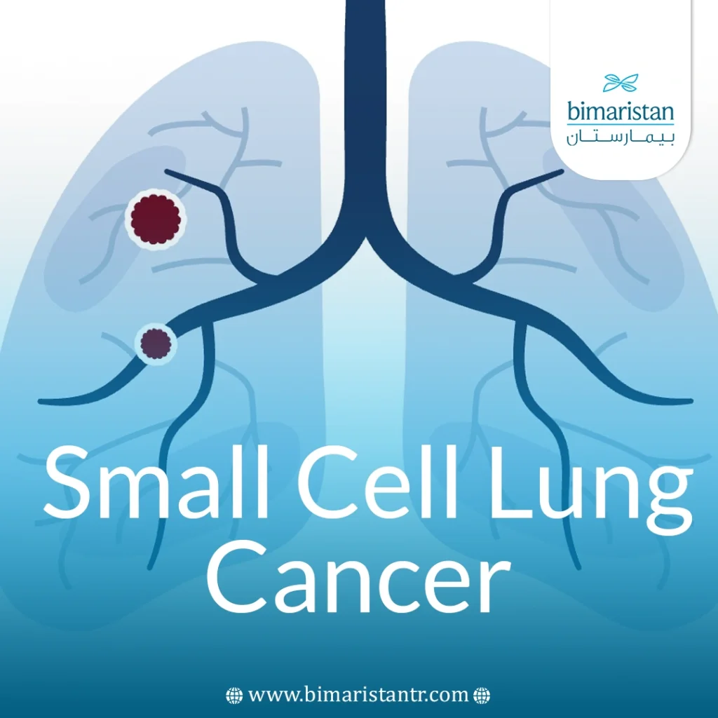 Small Cell Lung Cancer