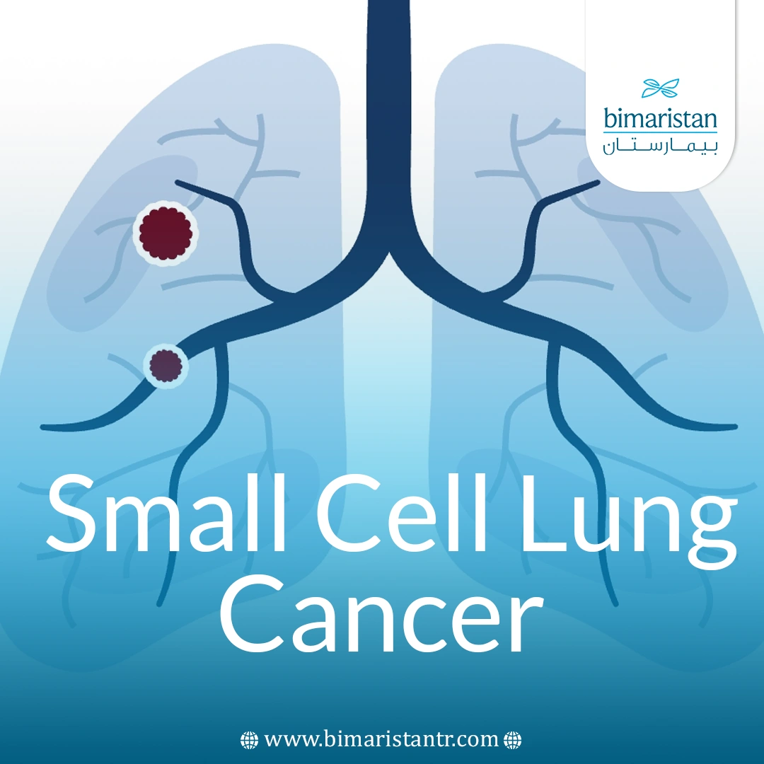 Small Cell Lung Cancer