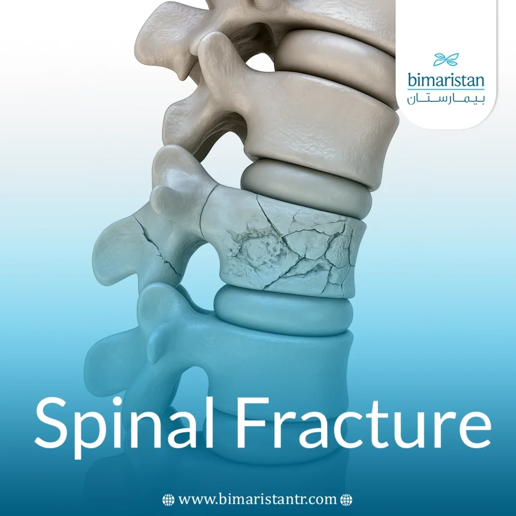 Spinal Fracture