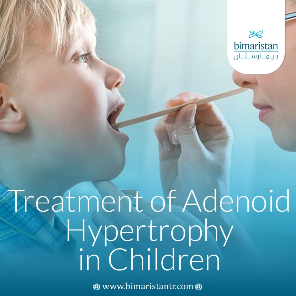 Treatment Of Enlarged Adenoids In Children 4 Treatment Of Enlarged Adenoids In Children