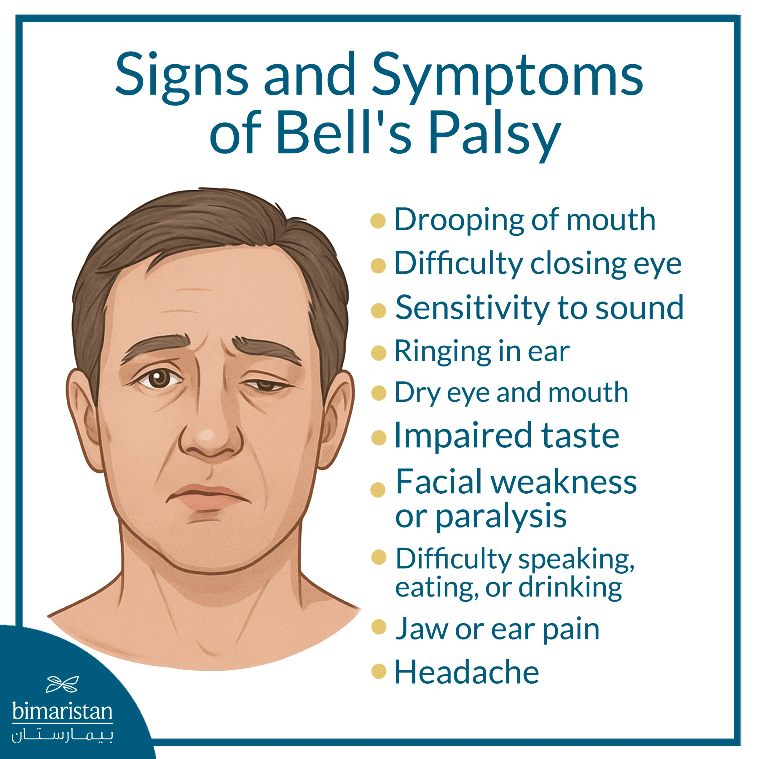 Facial Nerve Palsy: Causes And Treatment 3 The Image Shows The Main Symptoms Of Bell’s Palsy.