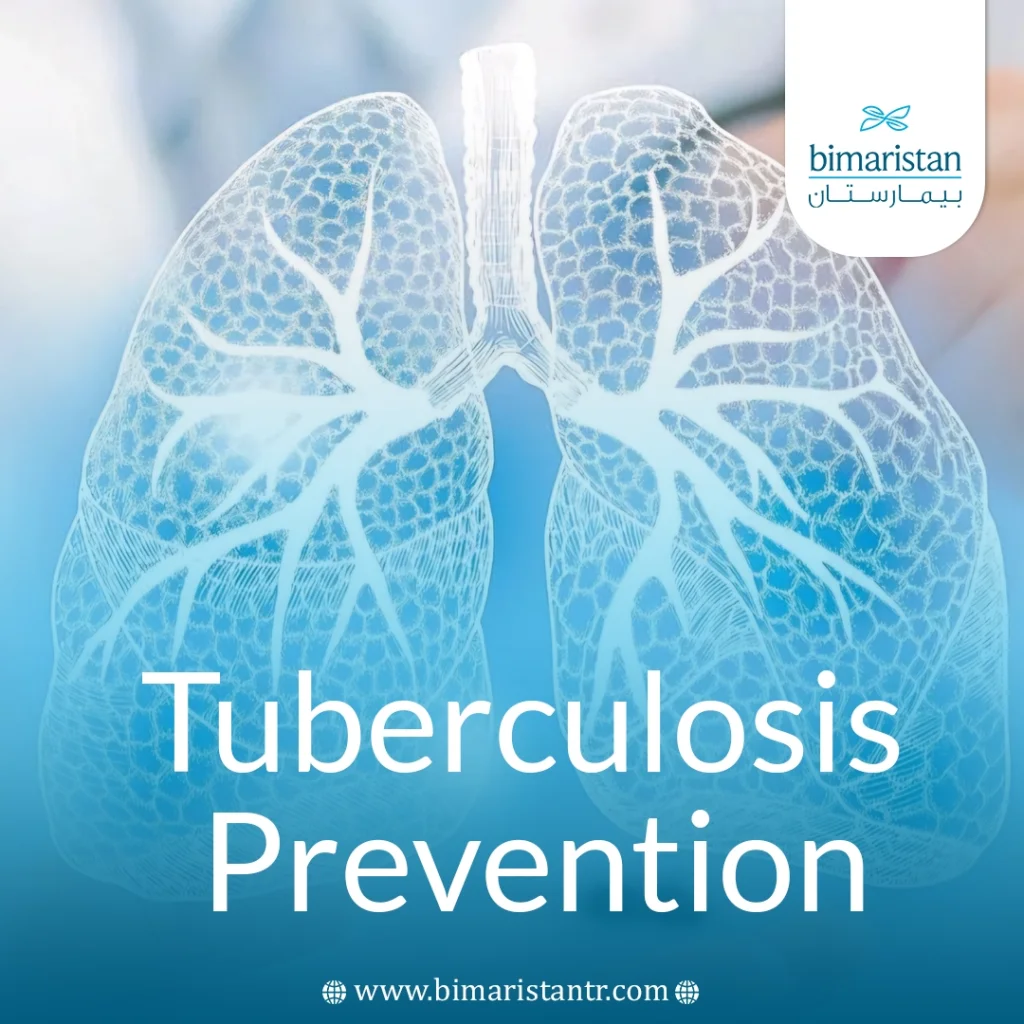 Tuberculosis Prevention: The Most Important Ways To Protect Yourself And Those Around You 5 Tuberculosis Prevention