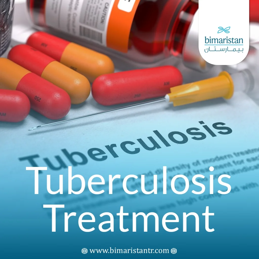 Tuberculosis Treatment: The Latest Medications And Protocols 5 Tuberculosis Treatment