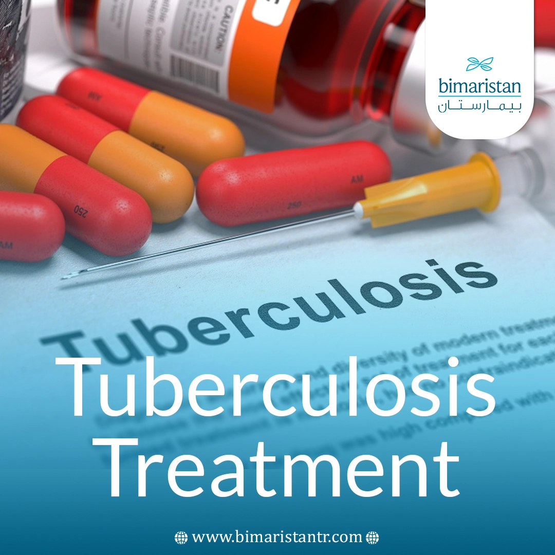 Tuberculosis Treatment