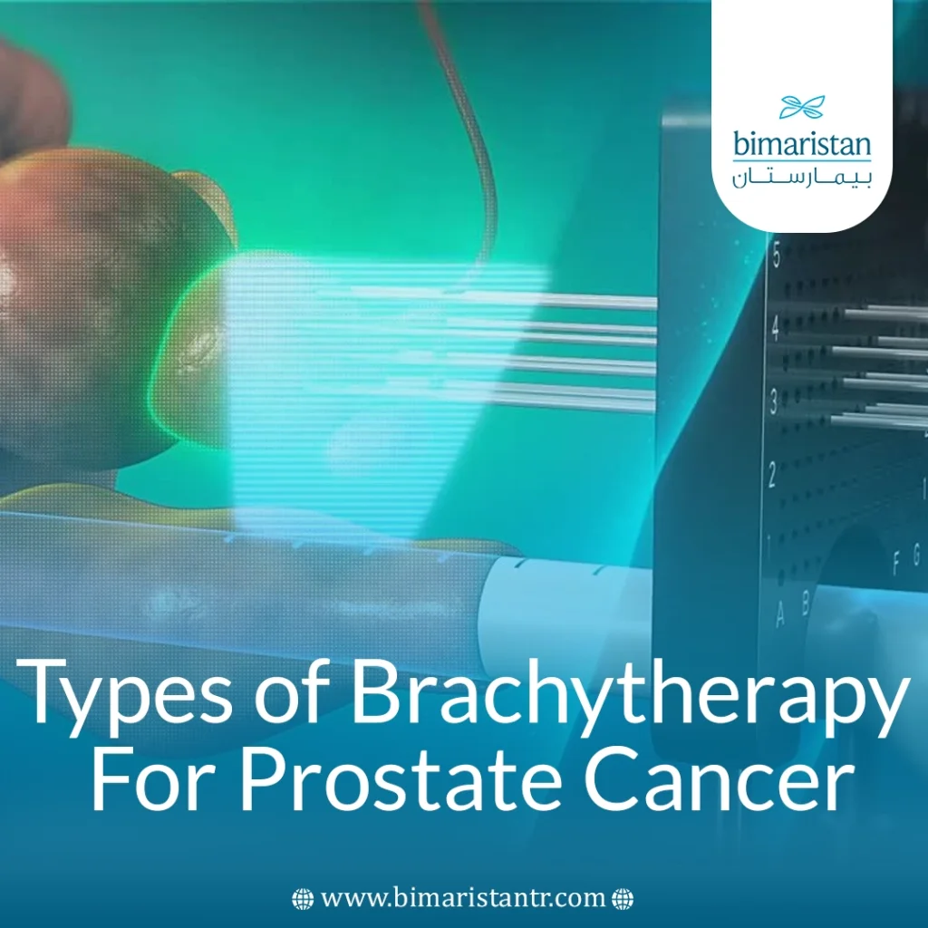 Types Of Brachytherapy For Prostate Cancer