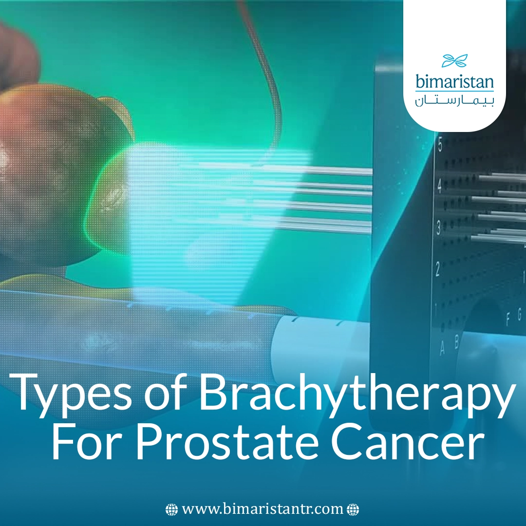 Types Of Brachytherapy For Prostate Cancer