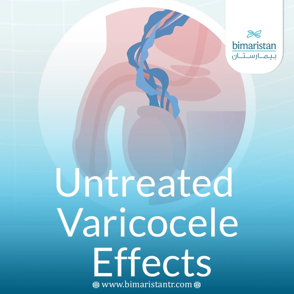 Untreated Varicocele Effects