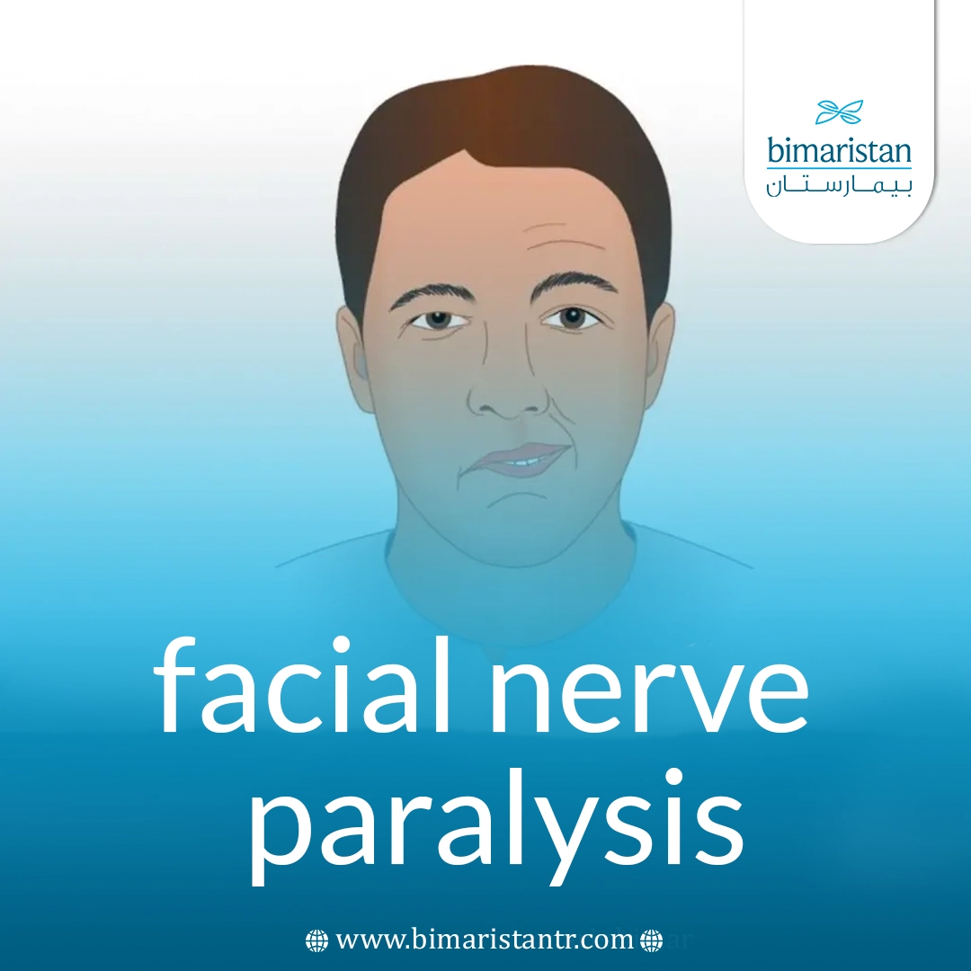 Facial Nerve Paralysis
