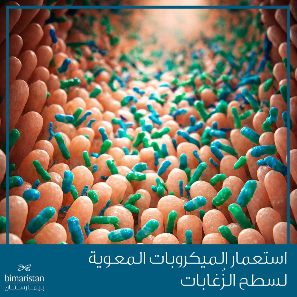 نقل البراز
