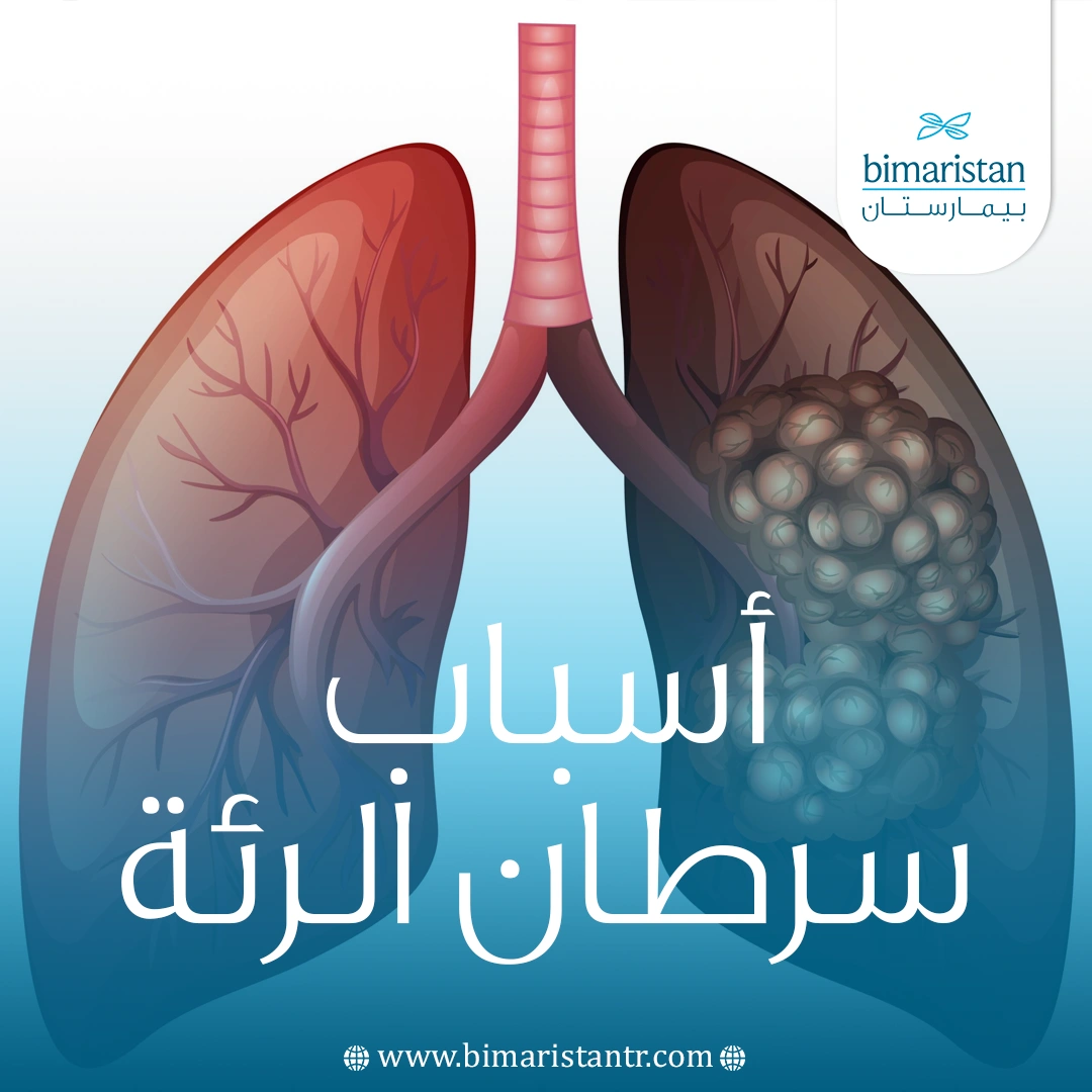 أسباب سرطان الرئة