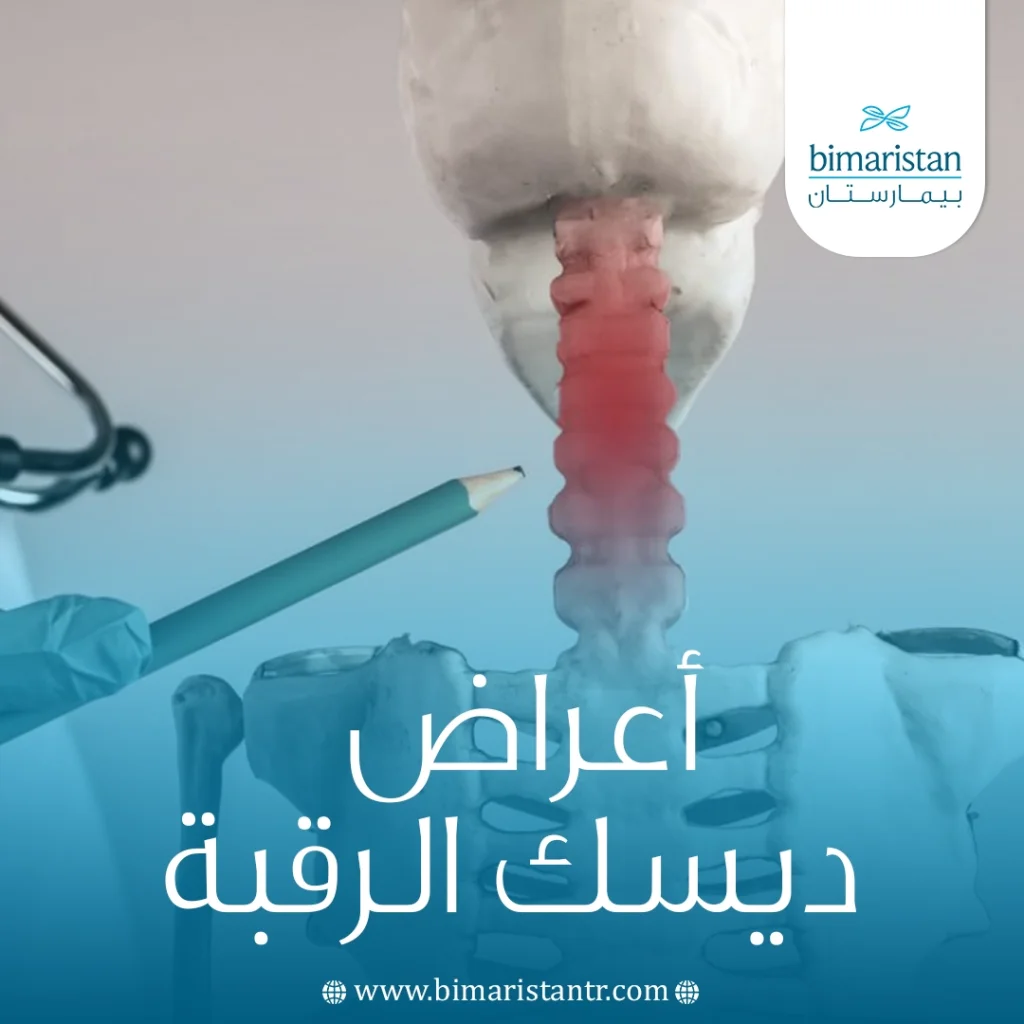 أعراض ديسك الرقبة