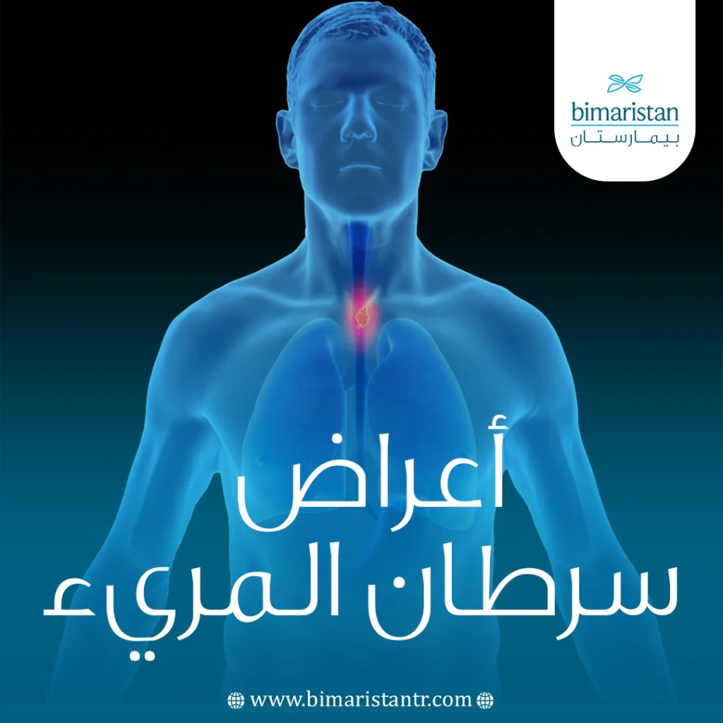 أعراض سرطان المريء