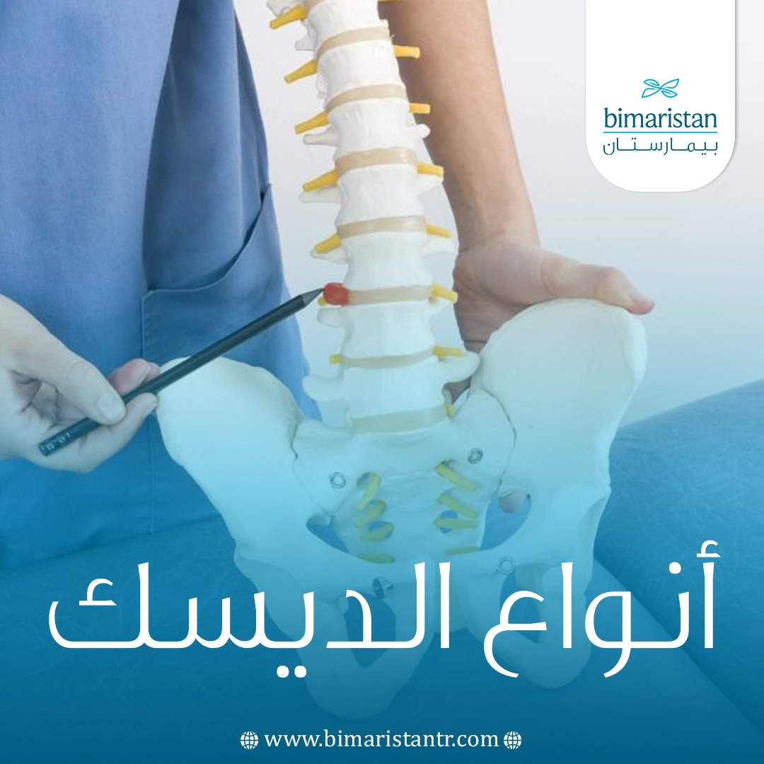 أنواع الديسك