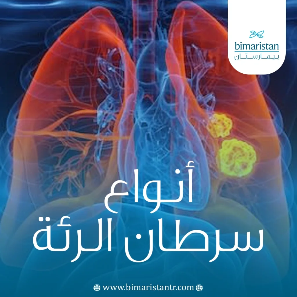 أنواع سرطان الرئة