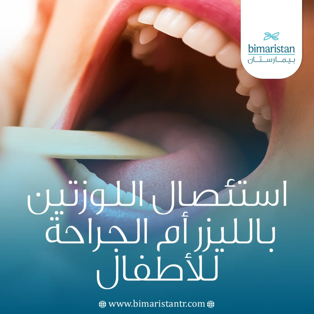 استئصال اللوزتين بالليزر أم الجراحة للأطفال: أيهما الخيار الأفضل؟ 4 استئصال اللوزتين باليزر أم الجراحة للأطفال