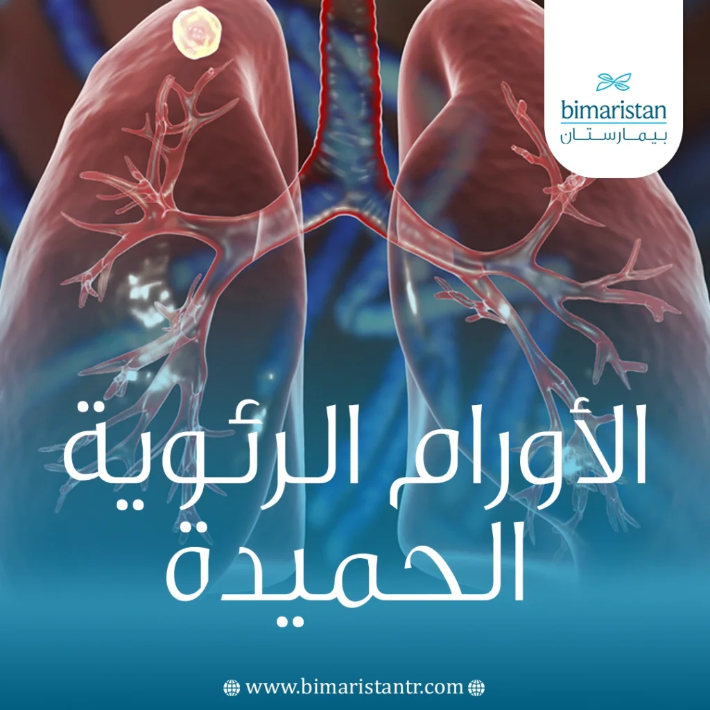 الأورام الرئوية الحميدة
