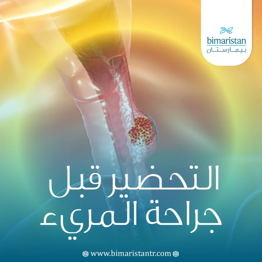 التحضير قبل جراحة المريء